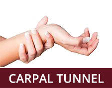 carpal Tunnel Syndrome