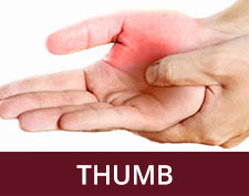 Repetitive Thumb Injury